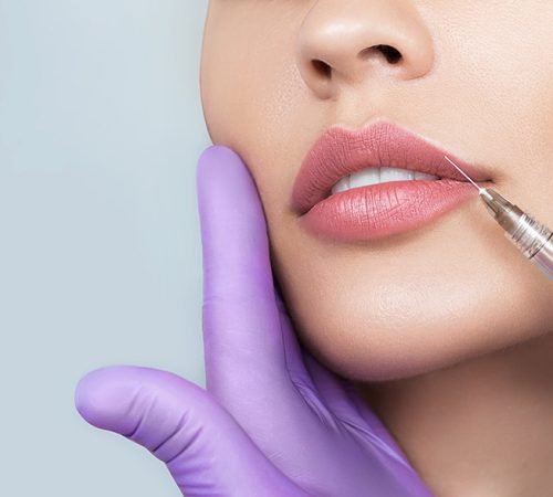 Fillers and Botox